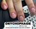 Onychophagie, Nägelkauen professionell behandeln, als Nageldesignerin in der Schweiz